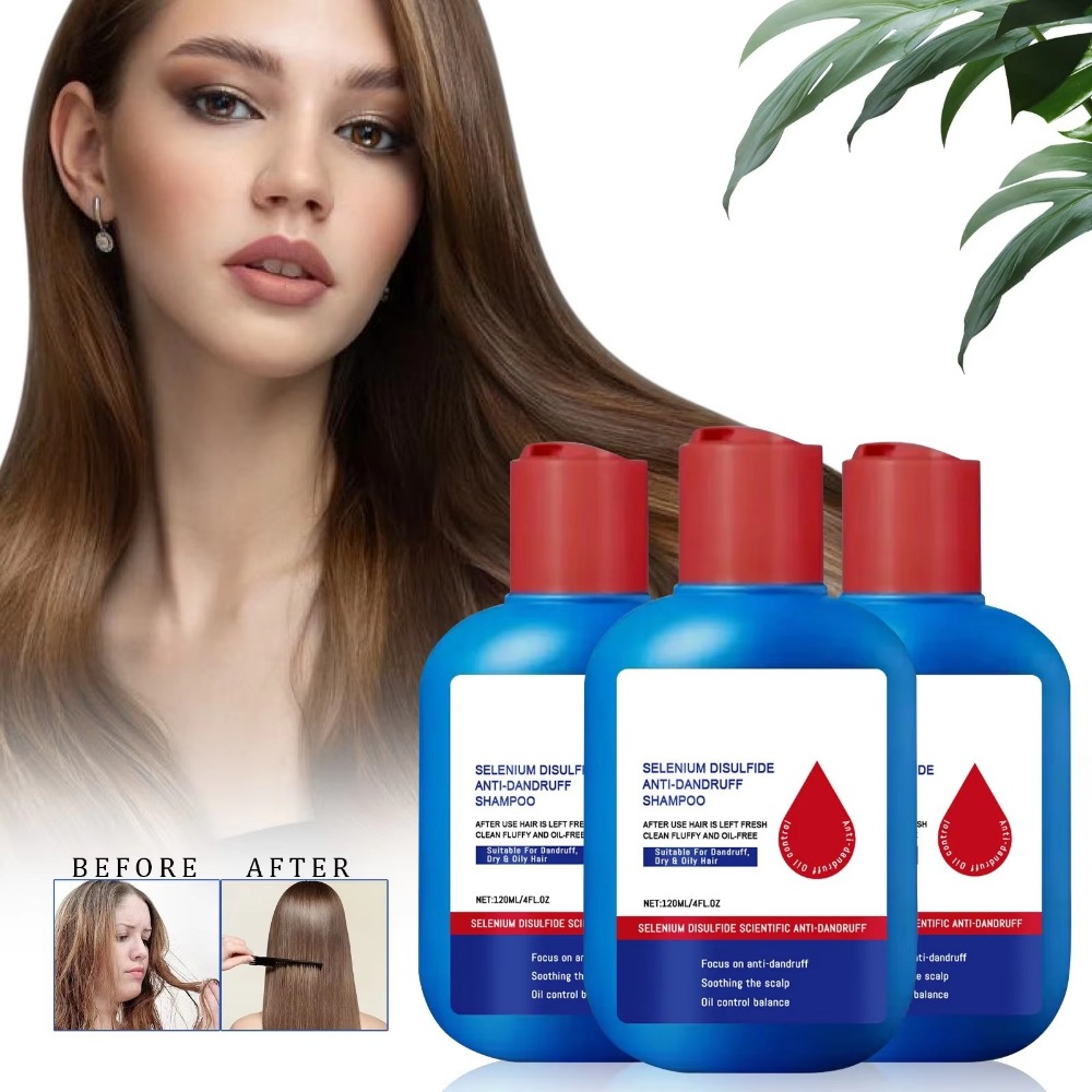 Neues 120ml Nipori Shampoo zur – Hair Care Dandruff Bewertung und Preis